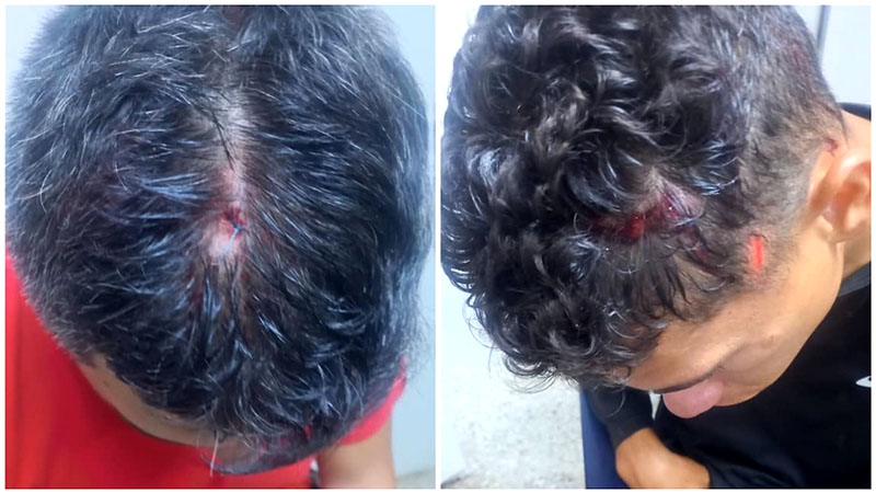 Asaltados por hombres fuertemente armados dos policías y un GN en Aragua