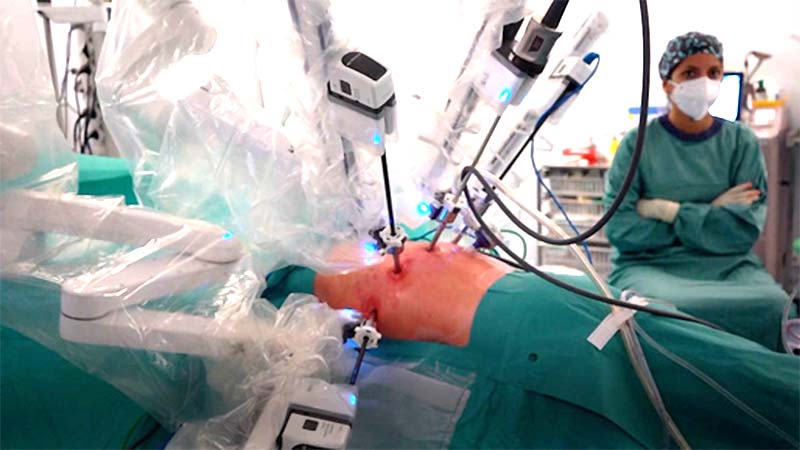 Trasplante pulmonar completamente robótico 