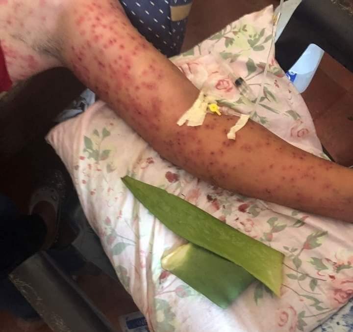 Seis pasajeros murieron atacados por abejas