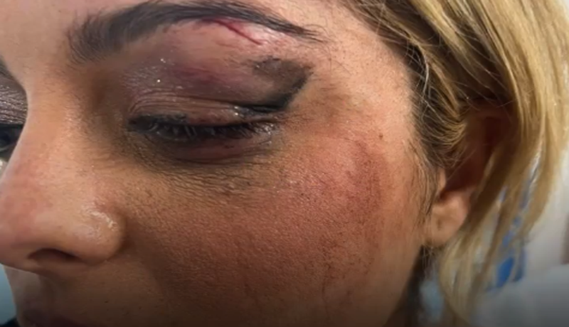 la talentosa cantante Bebe Rexha sufrió un desafortunado incidente mientras se presentaba ante miles de fanáticos en la azotea del Pier 17 de Nueva York.