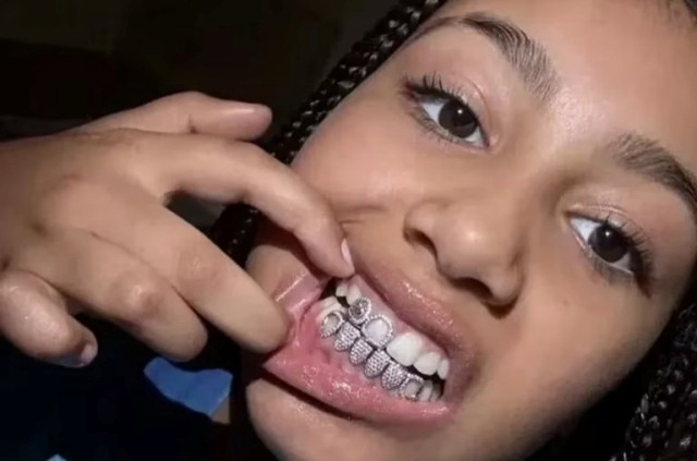 Dentadura de titanio del cantante Kanye West vale 850 000 dólares