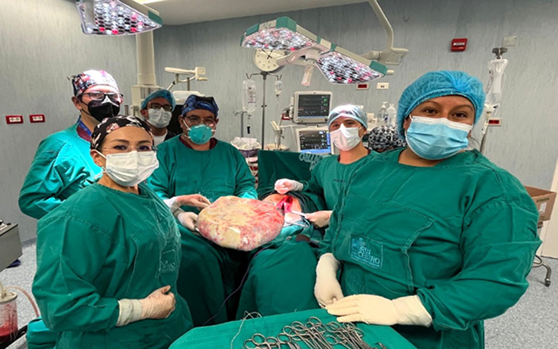 Extirpan un tumor con más de 50 kilos del abdomen de una mujer en Italia
