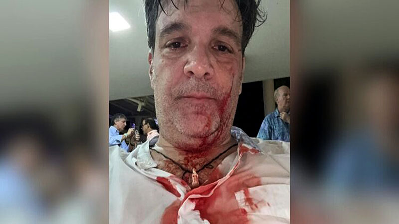 Ricardo Cusanno fue agredido por exsocio 