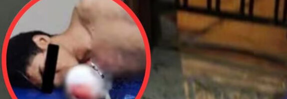 Delincuente venezolano pierde una mano al explotar una dinamita en extorsión