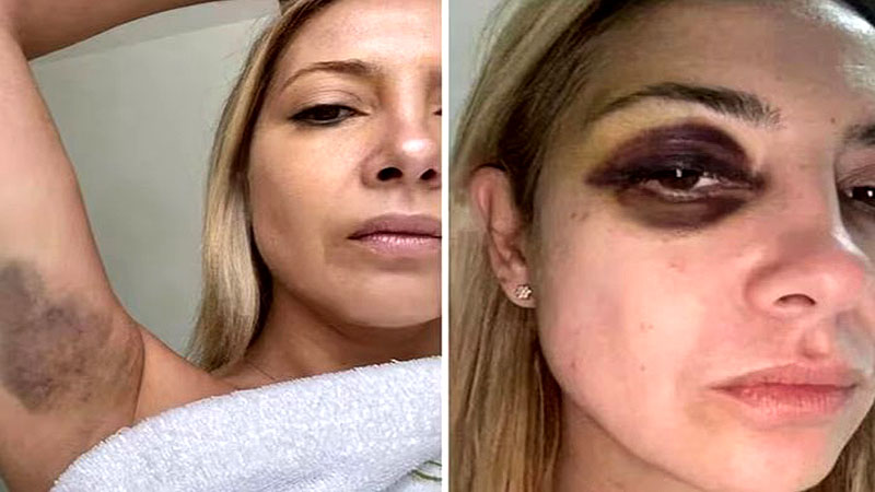 Así golpeaba Alberto Fernández a su expareja