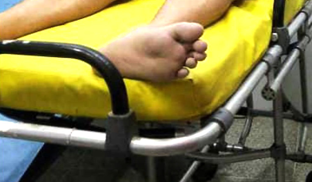 Turista barinés muere en Falcón tras comer langosta