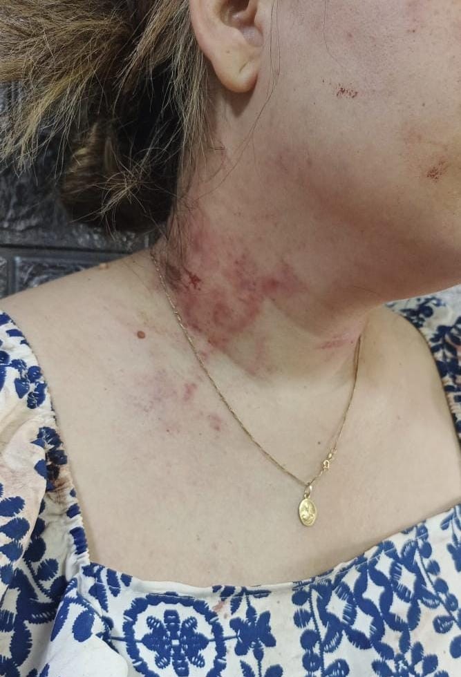 Polimaracaibo detiene al hombre que golpeó brutalmente a su expareja