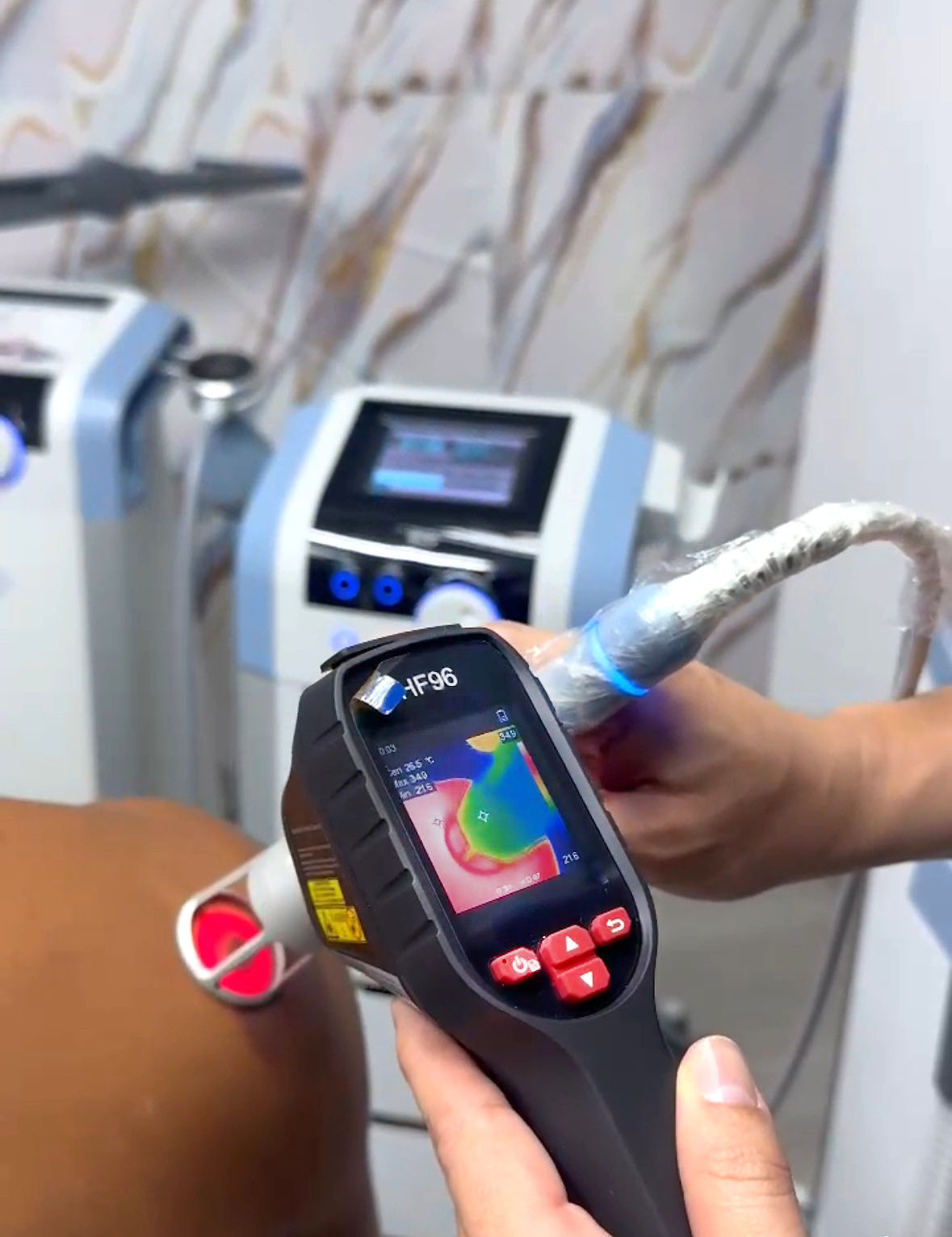 Tecnología regenerativa para el tratamiento de lesiones
