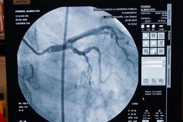 Gobierno Bolivariano inicia Plan Corazón Zuliano con la atención de 80 pacientes (2)