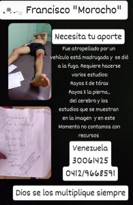 Lagunillas: Dos amigos iban en una bicicleta y fueron impactados por un carro