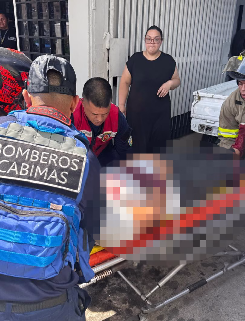 Colisión de motocicletas en Cabimas deja dos heridos en Cabimas